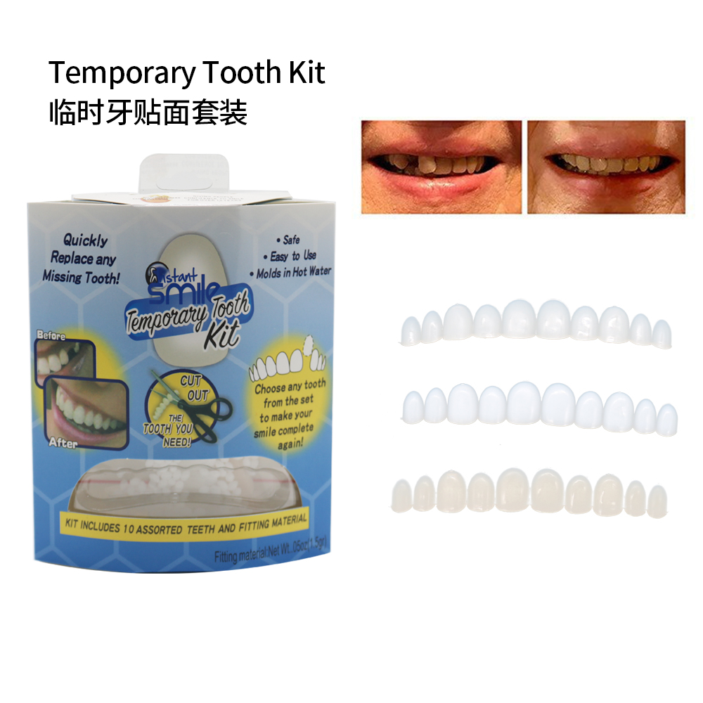 Teeth Whitening With Braces - ฟันปลอมแบบแปะ วีเนียร์ ฟันบน ฟันล่าง แบบสแนป บราซ