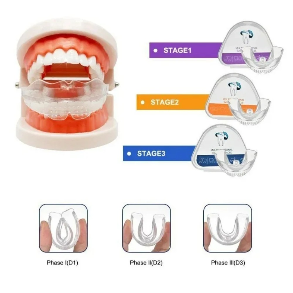Teeth Whitening For Braces - เครื่องมือจัดฟันแบบใสสำหรับผู้ใหญ่ 3 ระดับ อุปกรณ์เสริมทางทันตกรรม
