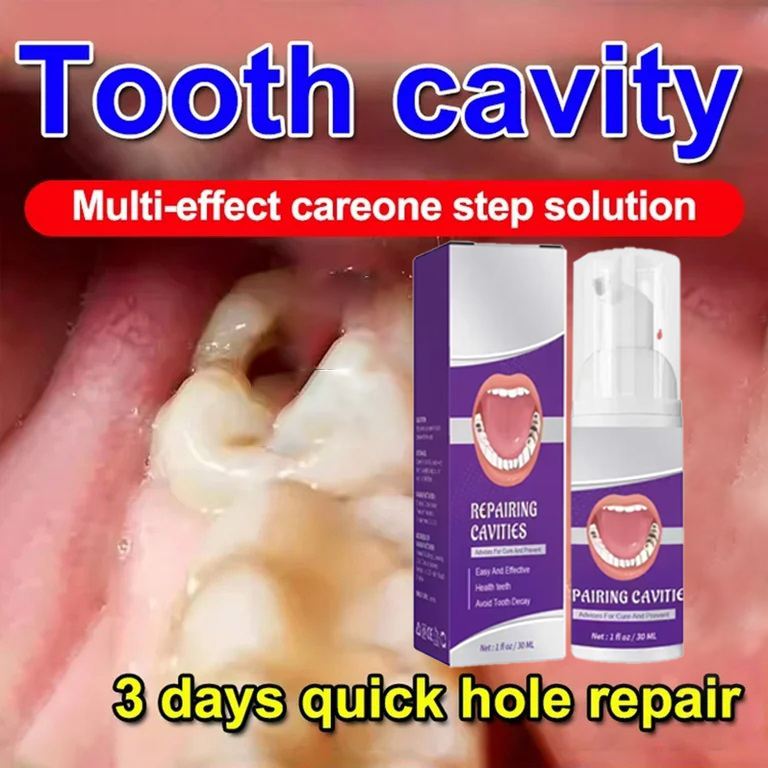 Teeth Whitening Treatment - ยาสีฟันทำความสะอาดฟัน ขจัดคราบฟัน ฟันขาวสะอาด ซ่อมแซมฟันผุ ขจัดคราบหินปูน คราบพลัค