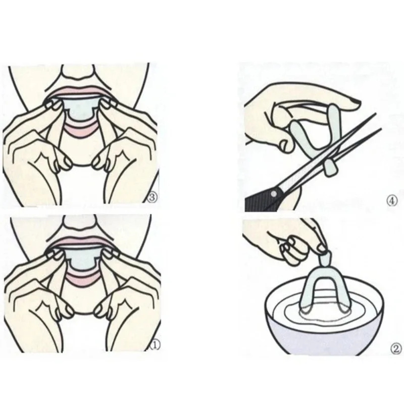 1/3/6 คู่ ที่ครอบฟันซิลิโคน ที - Teeth Whitening With Braces บทวิจารณ์และราคา