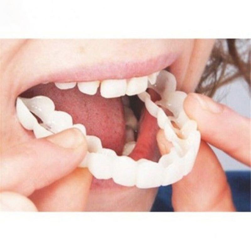 ฟันปลอมแบบสวม Perfect Fit ฟอกส - Teeth Whitening For Braces บทวิจารณ์และราคา
