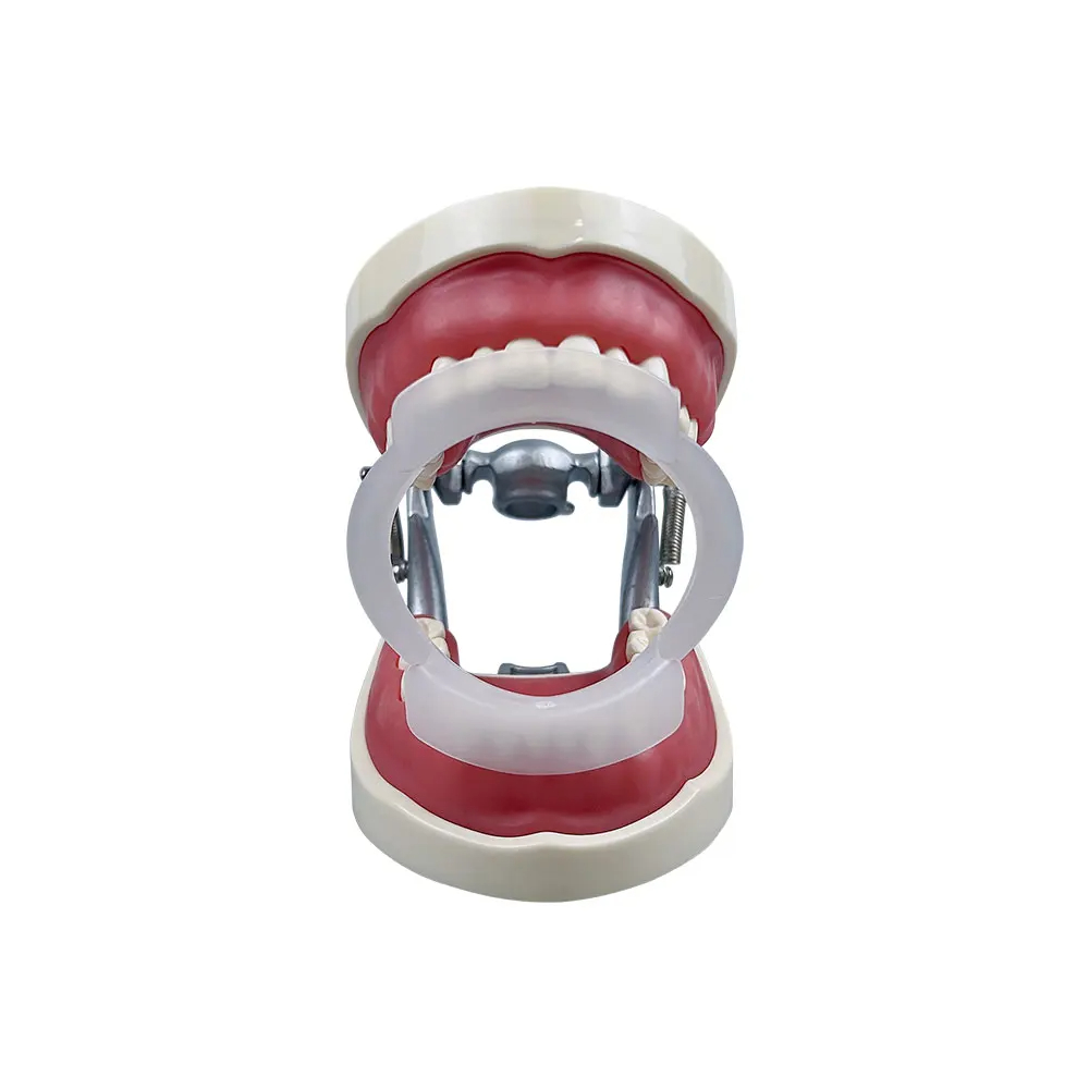 ที่ถ่างปากแบบวงรี 100 ชิ้น/ถุง - Teeth Whitening With Braces บทวิจารณ์และราคา