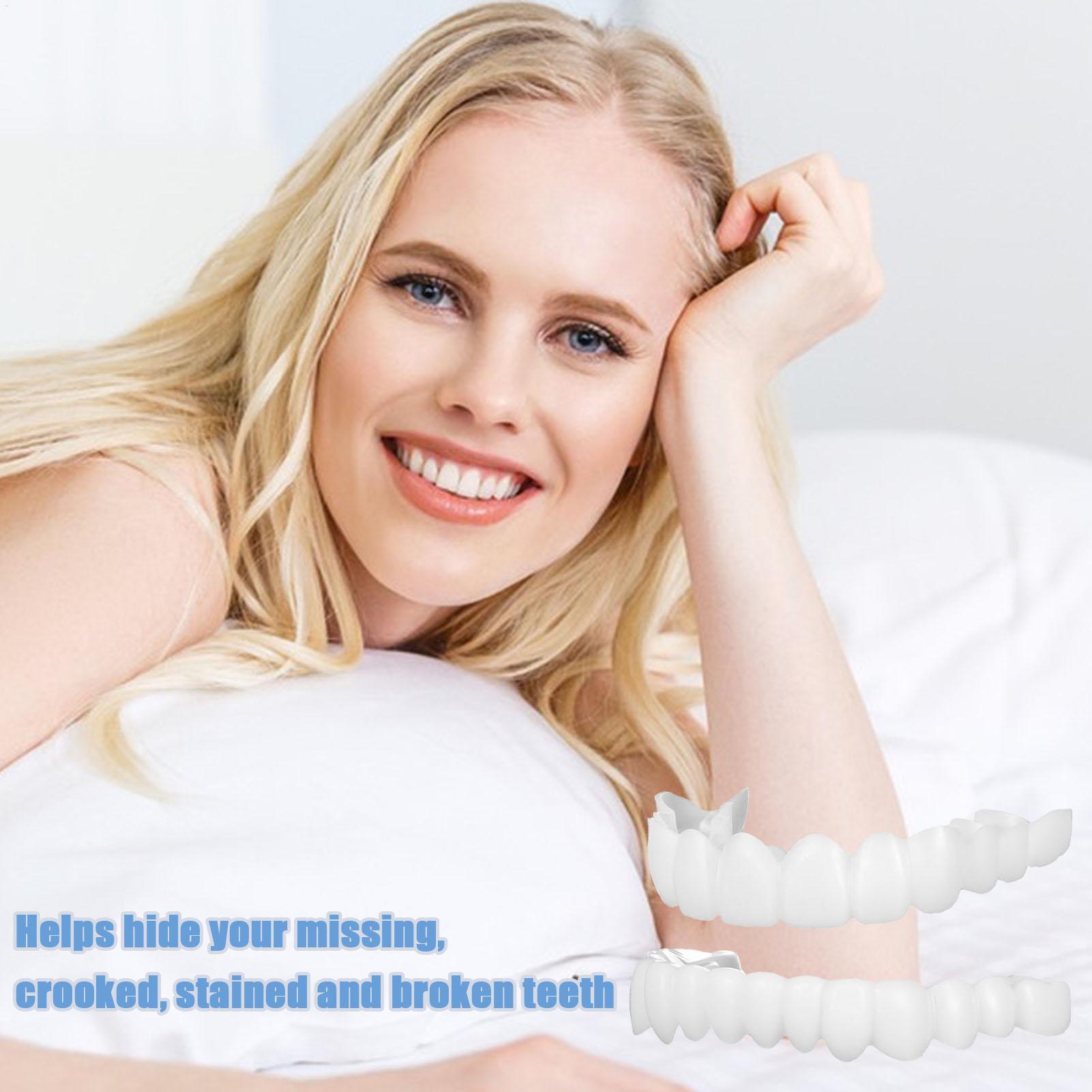 ฟันปลอมครอบฟันบนล่าง วีเนียร์ส - Teeth Whitening With Braces บทวิจารณ์และราคา
