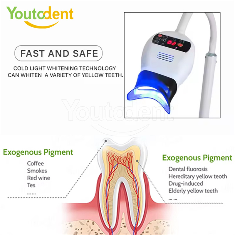Professional ทันตกรรม 3 สีโคมไ - Teeth Whitening/Bleaching บทวิจารณ์และราคา