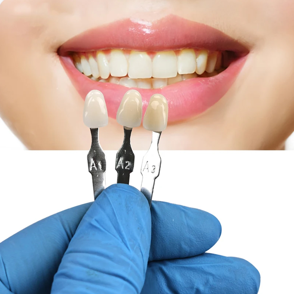 VITA ชุดอุปกรณ์ขัดฟันเพื่อฟันข - Teeth Whitening Shade Guide บทวิจารณ์และราคา