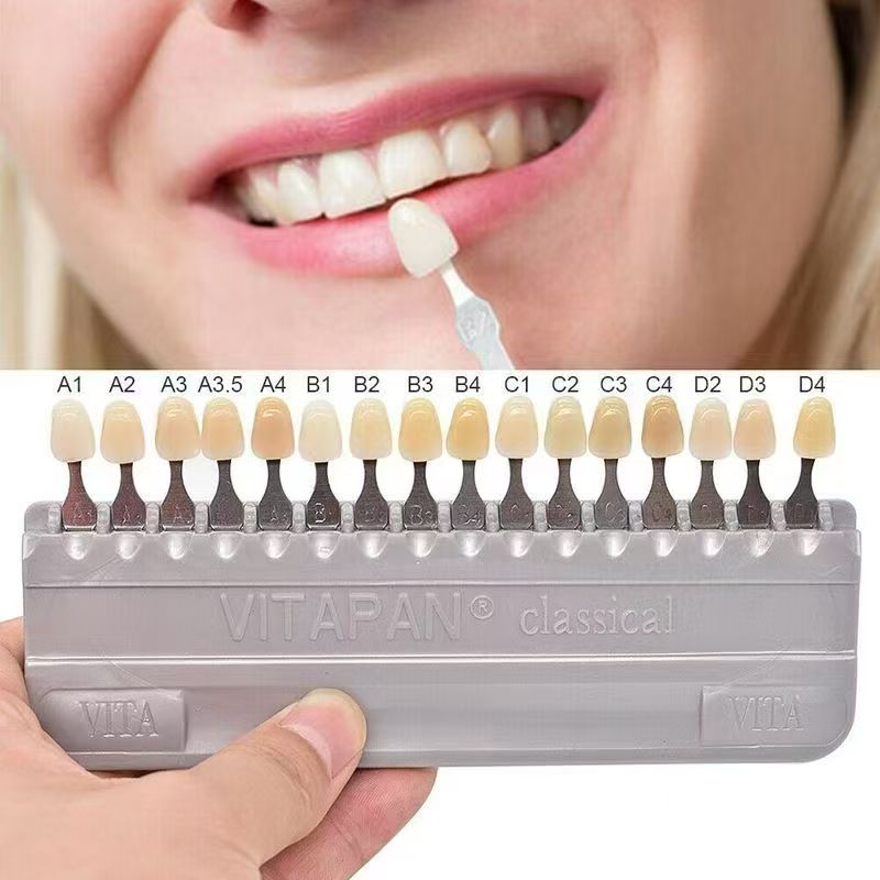 แผ่นสีฟัน VITA 16 สี แบบคลาสสิ - Teeth Whitening Shade Guide บทวิจารณ์และราคา