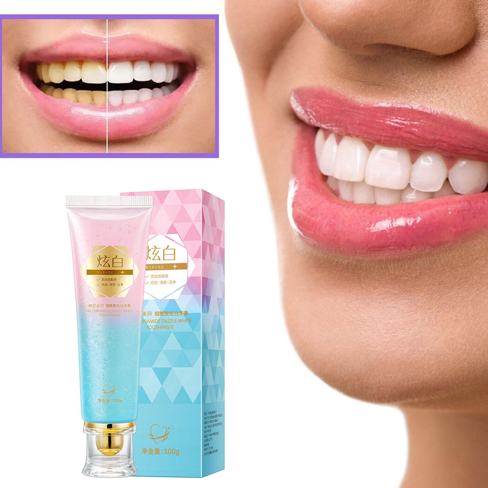 Niacinamide ยาสีฟันไวท์เทนนิ่ง - Teeth Whitening Treatment บทวิจารณ์และราคา