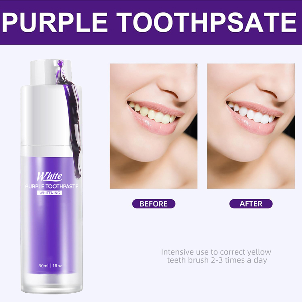 ยาสีฟันไวท์เทนนิ่งสีม่วง 30 มล - Teeth Whitening Treatment บทวิจารณ์และราคา
