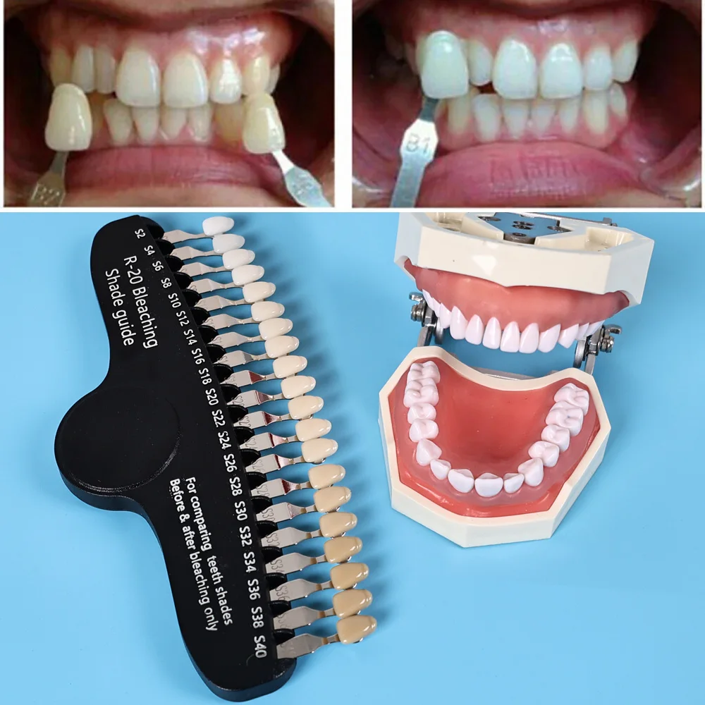 ELIJAH R-20 Bleaching Shade ท่ - Teeth Whitening Shade Guide บทวิจารณ์และราคา