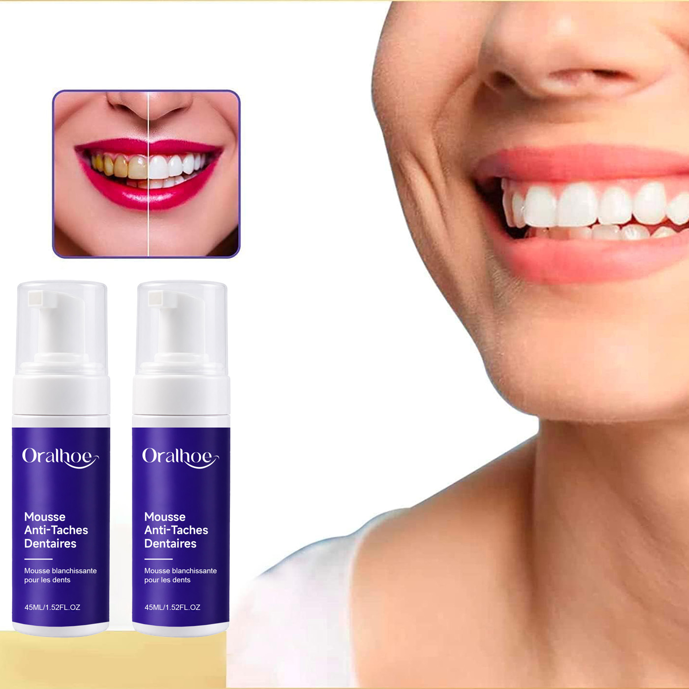 ยาสีฟันฟอกสีฟันสีม่วง โฟมไวท์เ - Teeth Whitening Routine บทวิจารณ์และราคา