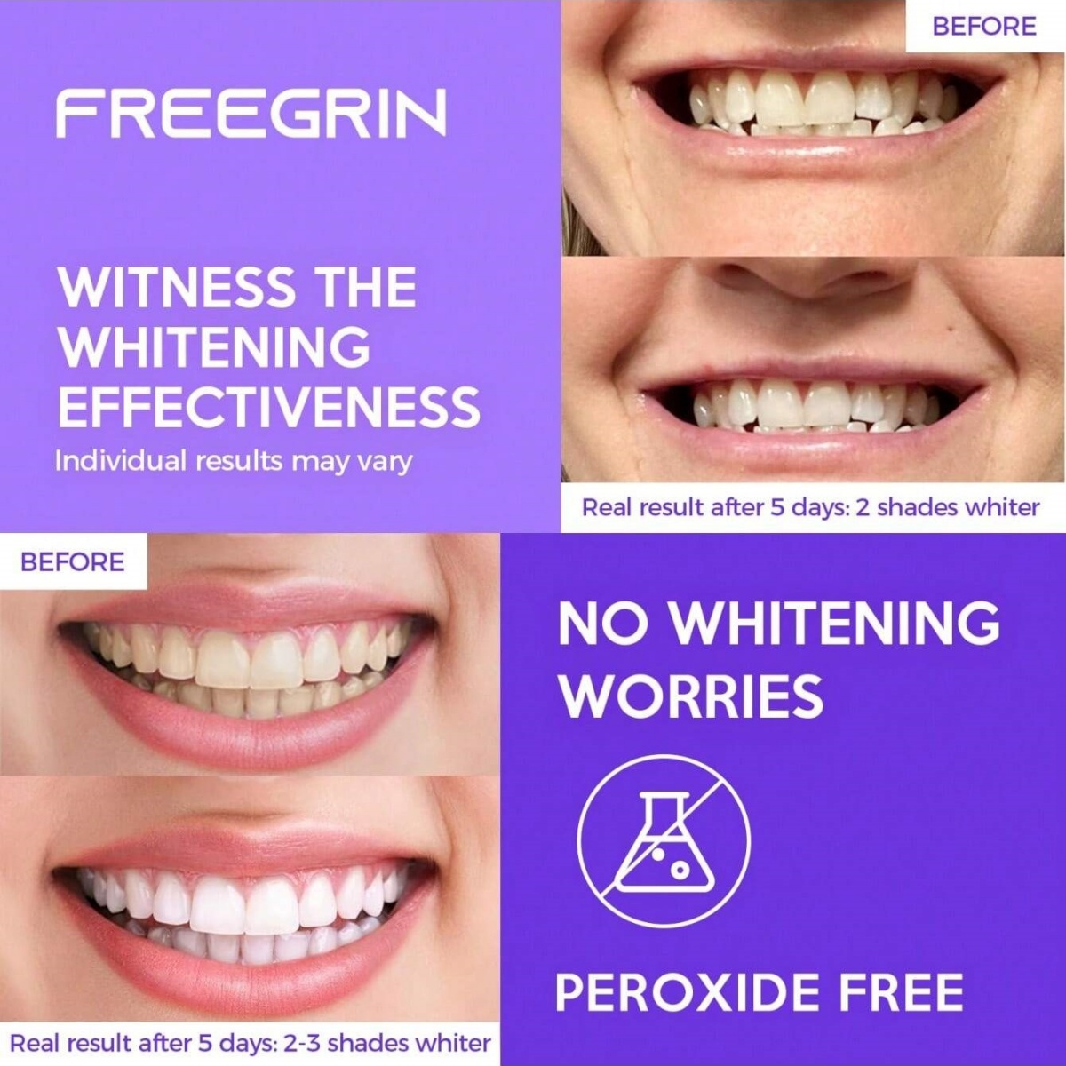 ดีลักซ์สติกเกอร์ฟอกสีฟัน 7/14/ - Teeth Whitening With Hydrogen Peroxide บทวิจารณ์และราคา