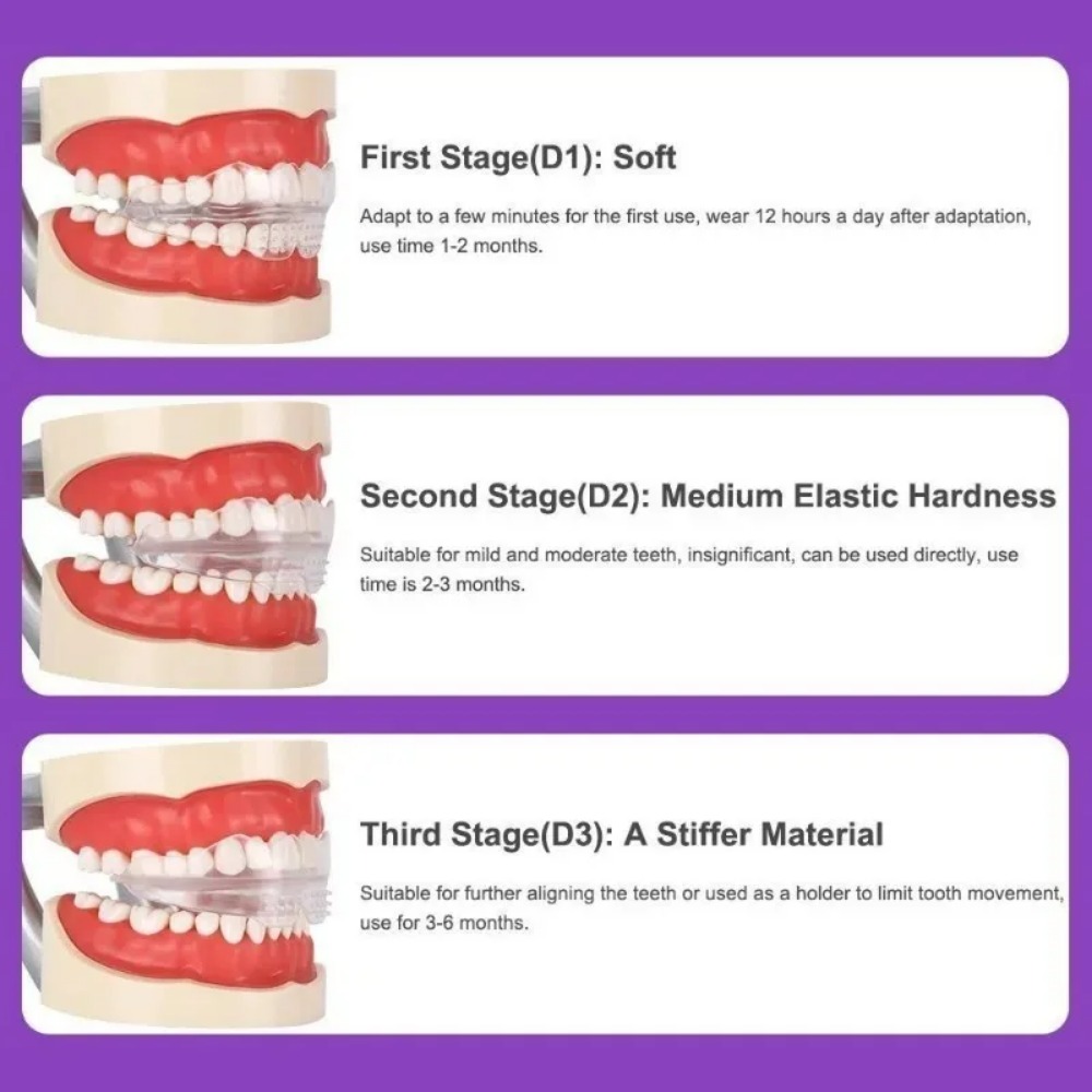 เครื่องมือจัดฟันแบบใสสำหรับผู้ - Teeth Whitening For Braces บทวิจารณ์และราคา