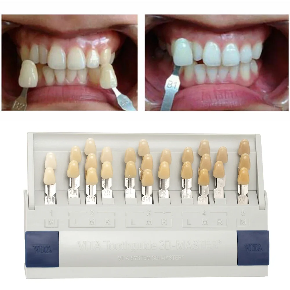 Vita 3D Master Dental Lab Blea - Teeth Whitening Shade Guide บทวิจารณ์และราคา