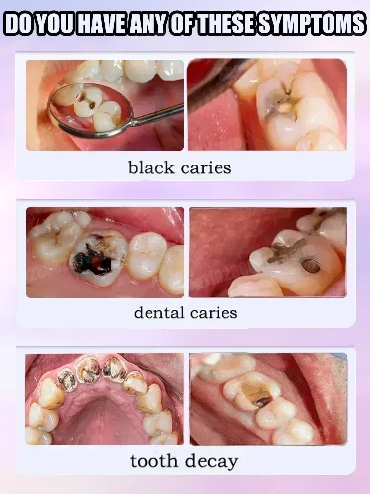 ยาสีฟันทำความสะอาดฟัน ขจัดคราบ - Teeth Whitening Treatment บทวิจารณ์และราคา